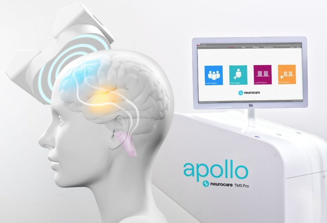 tms-brain-stimulation-apollo-neurocare-tms-pro