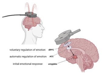TMS Depression Position On The Brain
